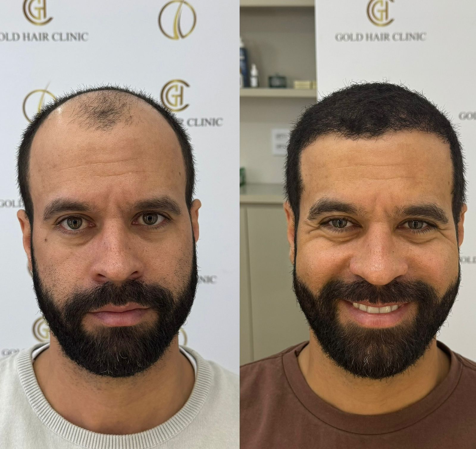 Resultado Paciente 2